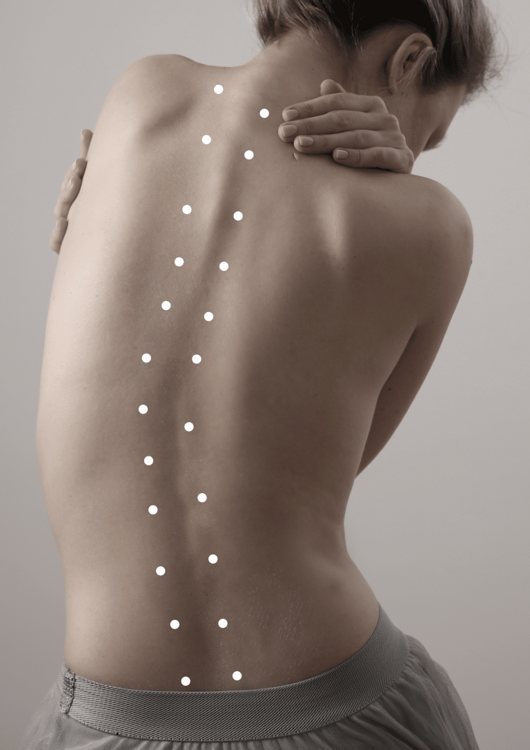 Scoliosis – Understanding the Different Kinds of Scoliosis | Foundation Chiropractic