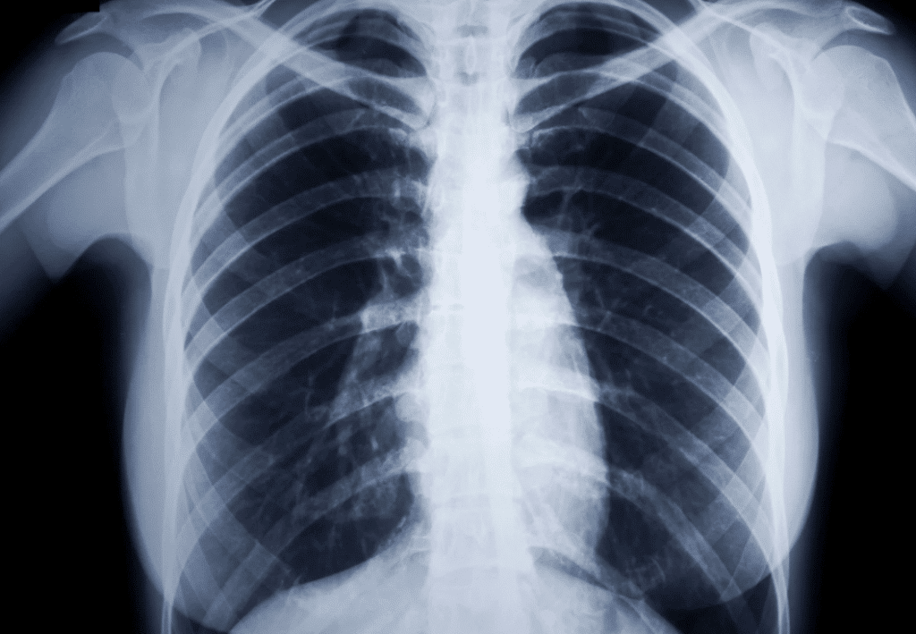 Chiropractic X Ray in Orem and Lehi Utah | Foundation Chiropractic