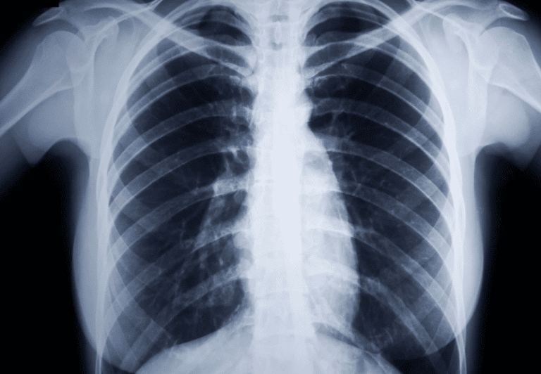 Chiropractic X Ray in Orem and Lehi Utah | Foundation Chiropractic