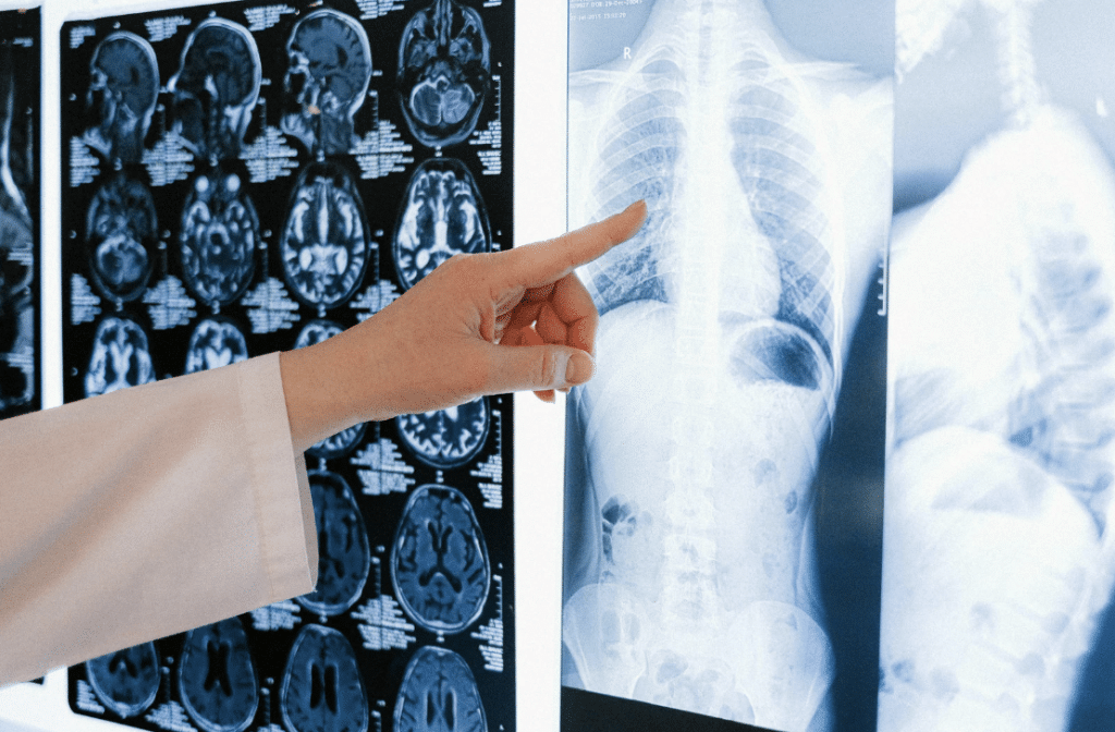 Chiropractic X-Rays in Lehi Utah | Foundation Chiropractic
