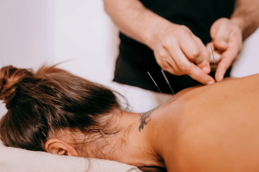 Dry needling1 | Foundation Chiropractic