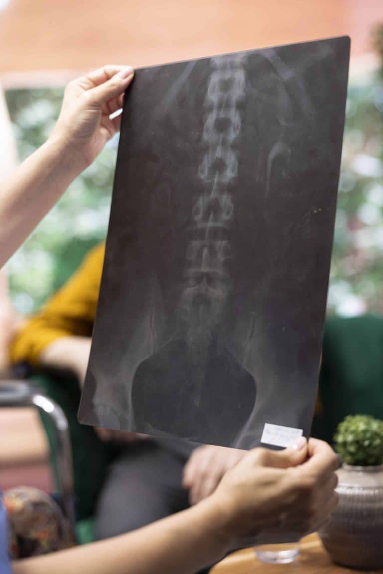 Deep tissue massage – Chiropractic X-Rays in Lehi Utah | Foundation Chiropractic