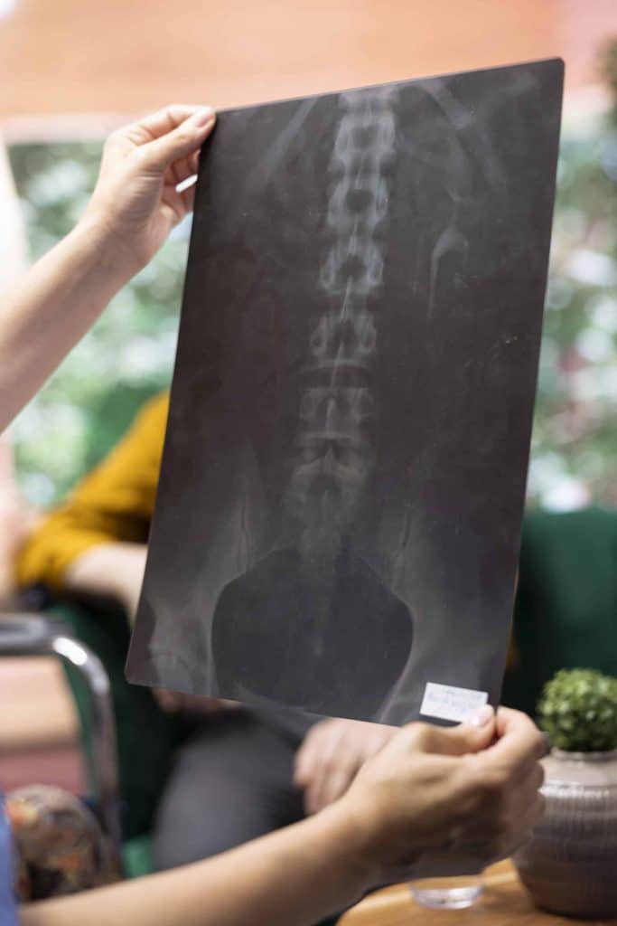 Medical caretaker presenting the x ray scan results and diagnosis, – How Much Does a Chiropractor Cost?